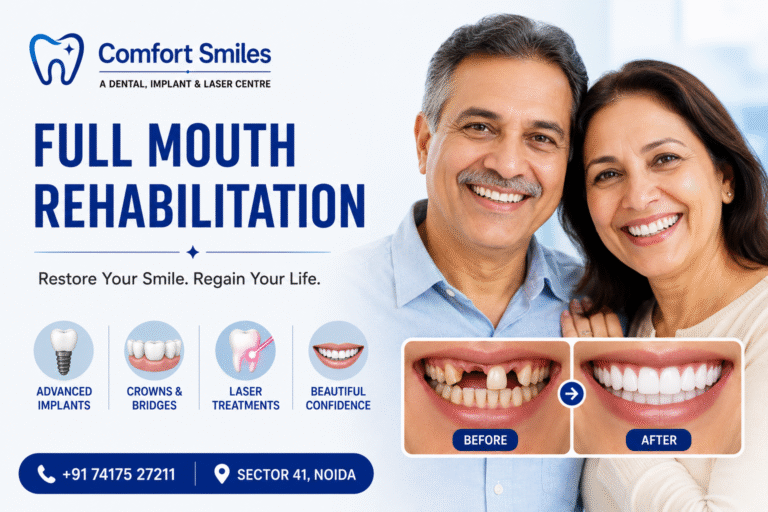 Full Mouth Rehabilitation: The Complete Solution to Regain Your Lost Smile and Chewing Power