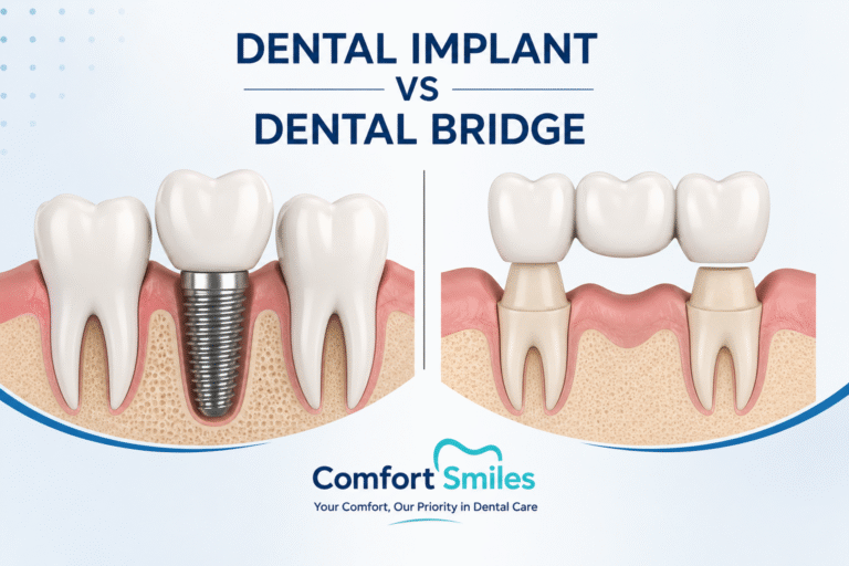 Dental Implants vs Dental Bridges: Which Tooth Replacement Option is Best in Noida?