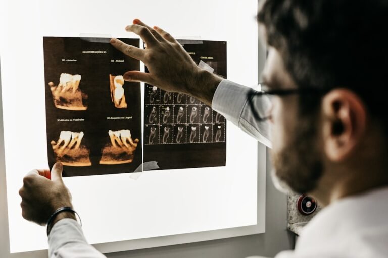 Apicoectomy (Root End Surgery): The Final Step to Save Your Natural Tooth
