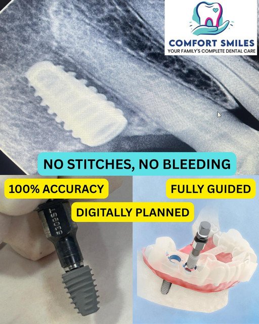 Laser Gum Treatment and LANAP at Comfort Smiles